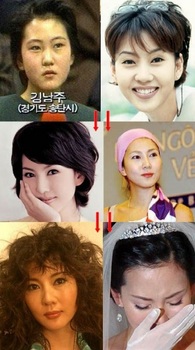 BS韓国、韓流ドラマ「逆転の女王」キム・ナムジュ整形前後の画像.jpg